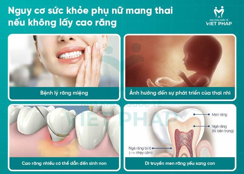 Nguy cơ sức khỏe nếu mẹ bầu không lấy cao răng