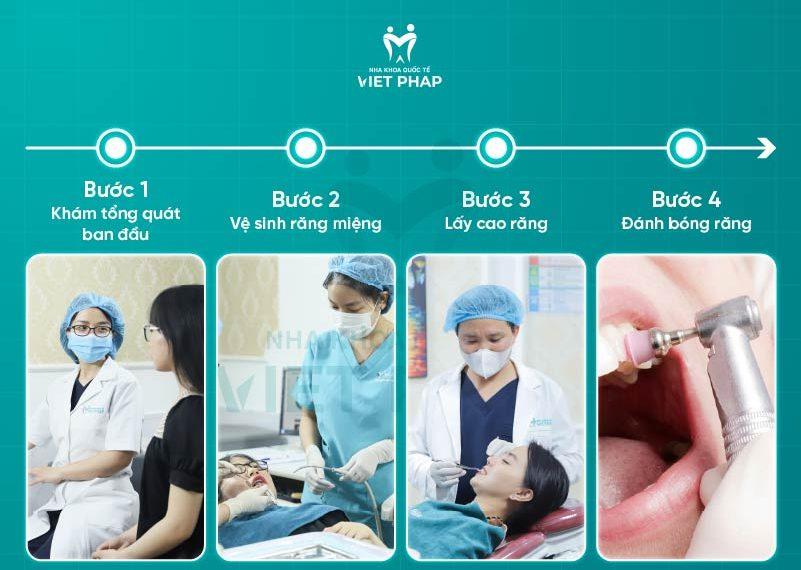 Quy trình lấy cao răng