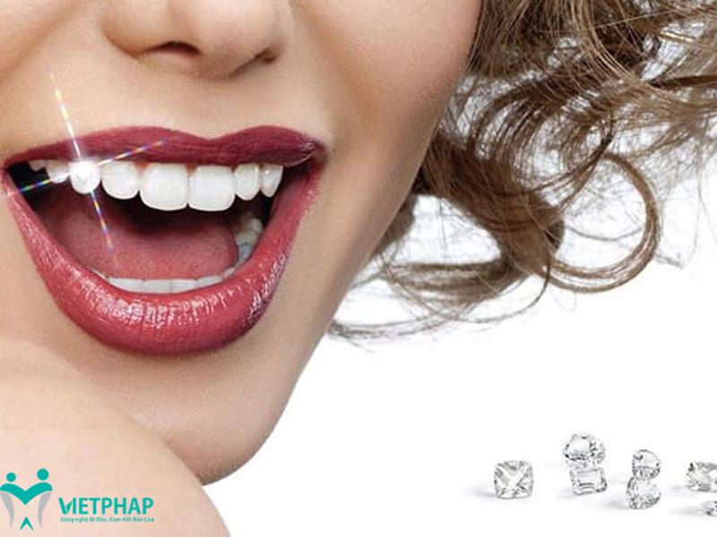Đính đá vào răng là quá trình gắn những viên đá quý hoặc kim cương nhỏ trực tiếp lên răng