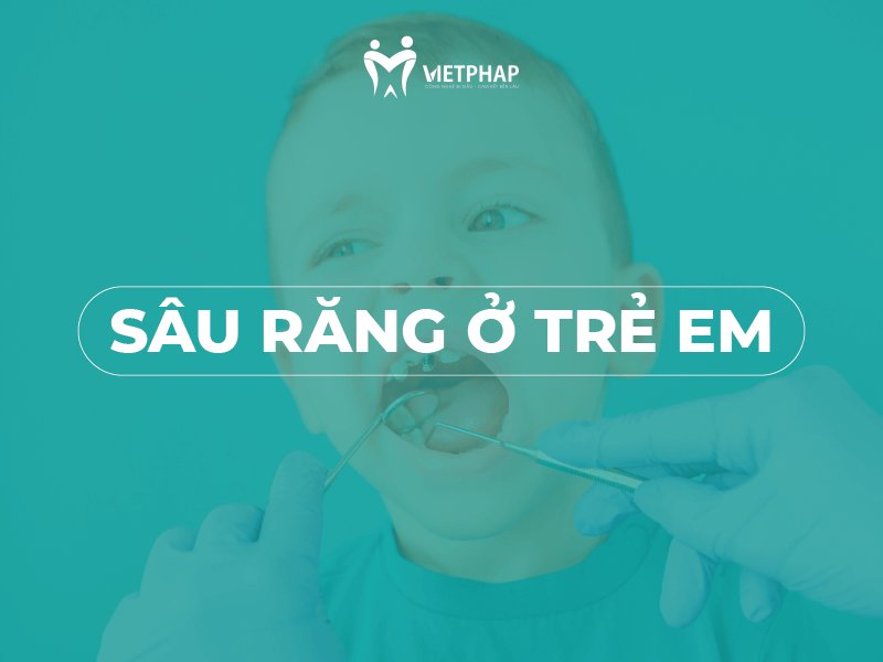 giai doan sau rang tre em Sâu răng ở trẻ em cao hơn người lớn