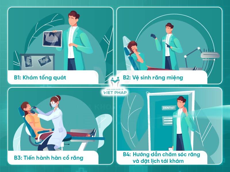 Quy trình hàn cổ răng chuẩn y khoa