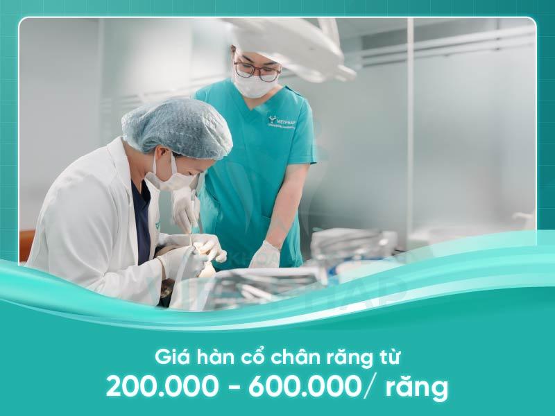 Giá hàn cổ răng từ 200.000 - 600.000 VNĐ/ răng
