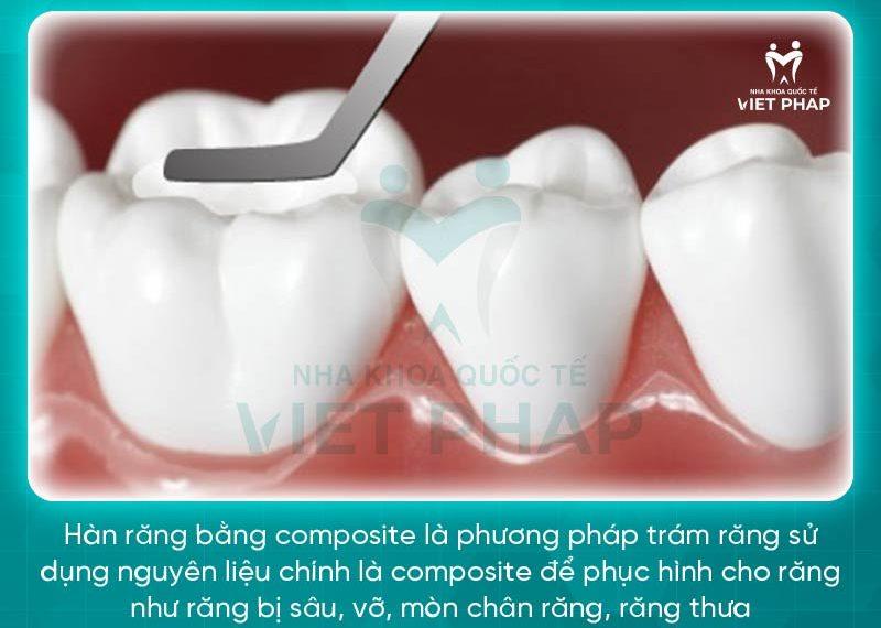 han rang bang composite 1 Hàn răng bằng composite là gì?