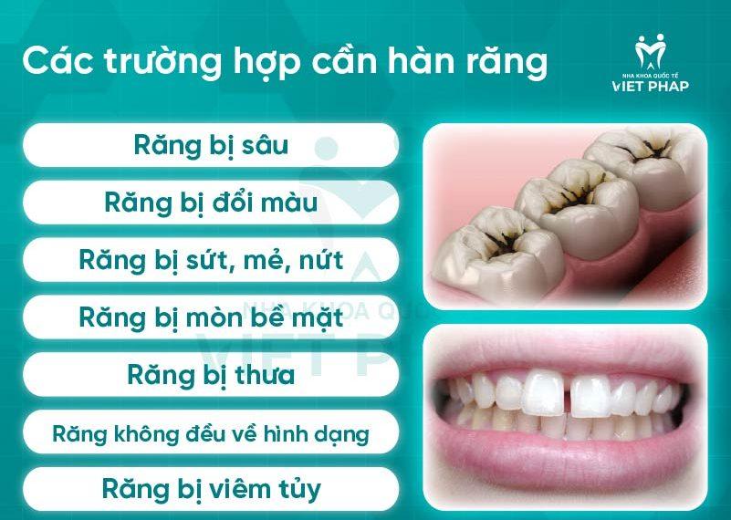 han rang bang composite 2 1 Các trường hợp cần hàn răng
