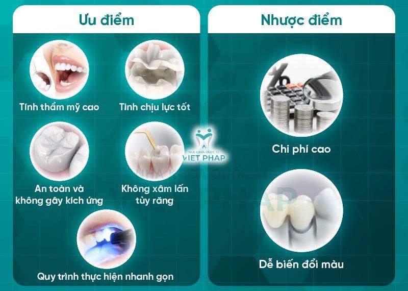 han rang bang composite 3 1 Các ưu - nhược điểm của hàn răng composite