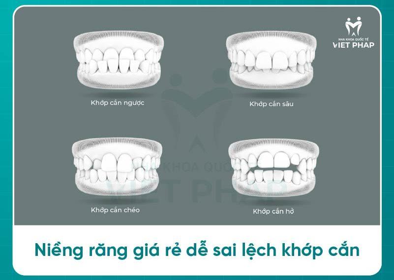 Niềng răng giá rẻ dễ lệch khớp cắn
