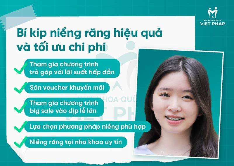 Bí kíp niềng răng hiệu quả và tối ưu chi phí