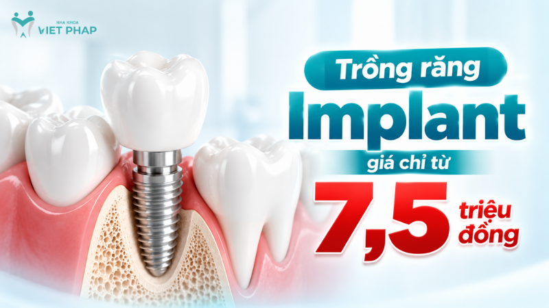 trong rang1 Nha khoa Việt Pháp triển khai chương trình ưu đãi trồng răng Implant giá chỉ từ 7,5 triệu đồng trên toàn hệ thống