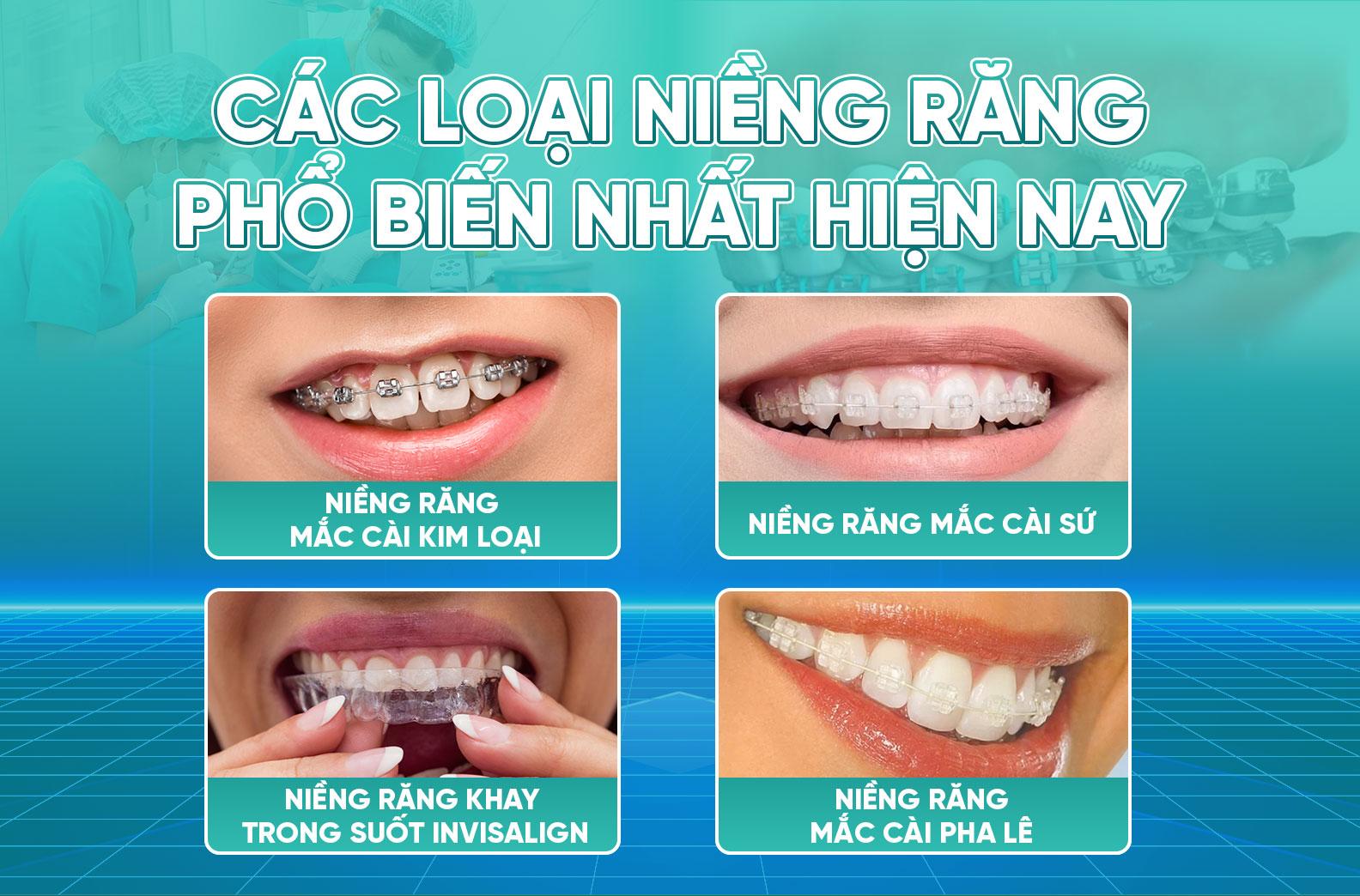 4 loai nieng rang 2