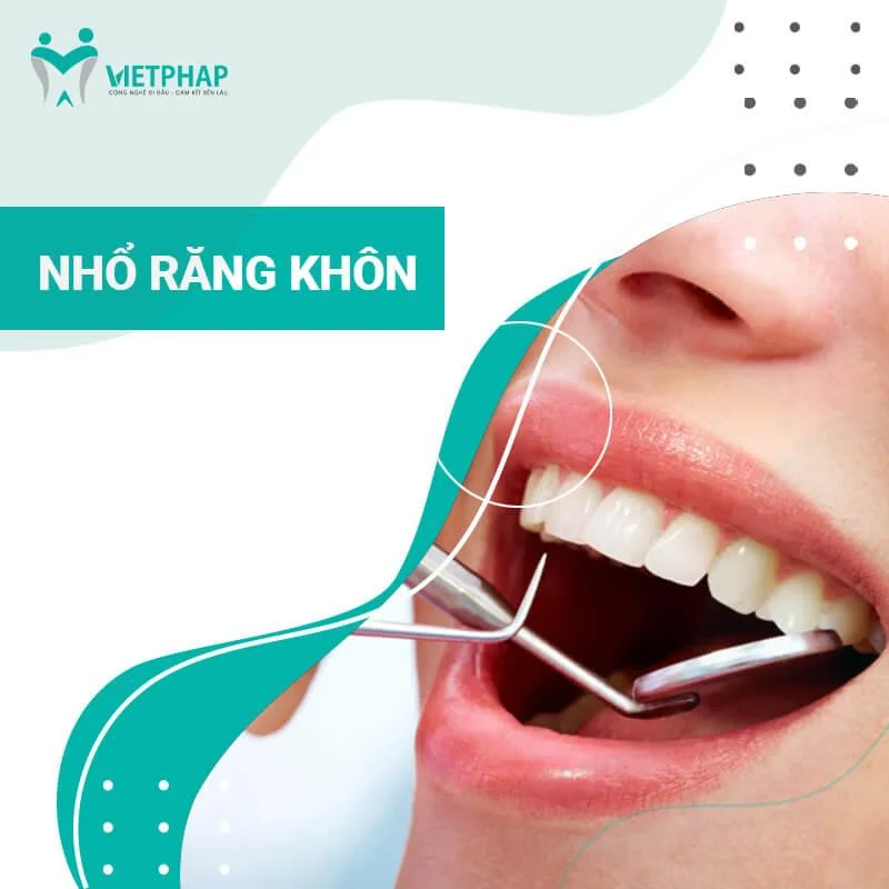 Răng khôn (răng số 8) là gì?