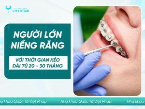 nieng rang nguoi lon 10 người lớn niềng răng kéo dài từ 20 - 30 tháng