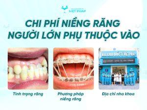 nieng rang nguoi lon 7 Chi phí niềng răng người lớn