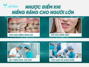 nieng rang nguoi lon 9 Nhược điểm khi niềng răng người lớn