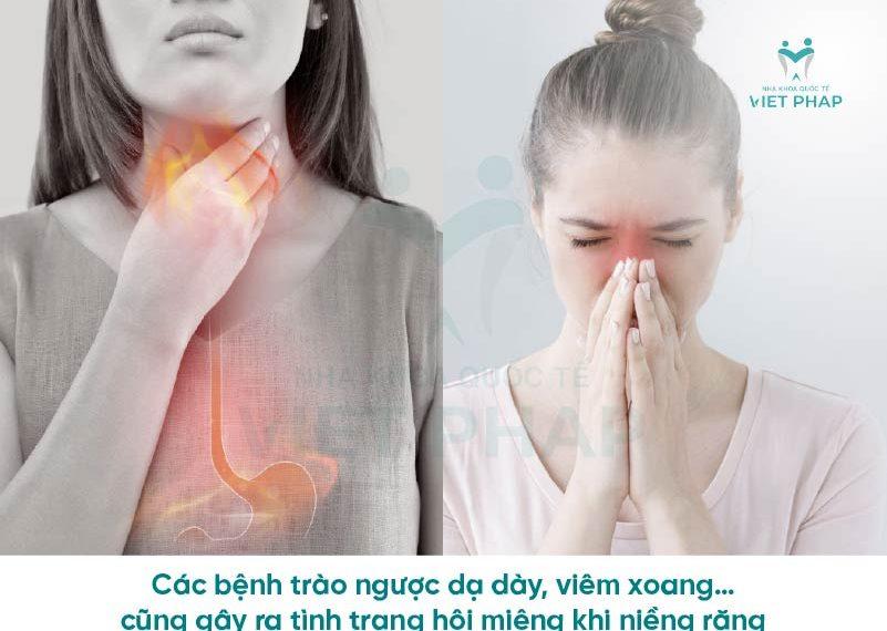 Các bệnh trào ngược dạ dày, viêm xoang… cũng gây ra tình trạng hôi miệng khi niềng răng