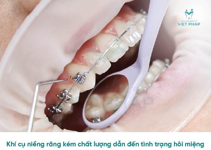 Khí cụ niềng răng kém chất lượng dẫn đến tình trạng hôi miệng
