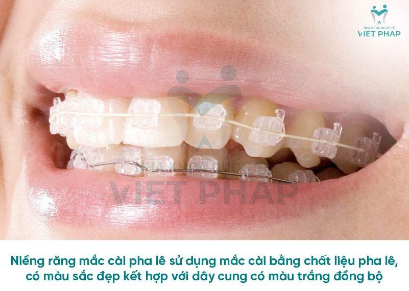 nieng rang pha le 1 Niềng răng mắc cài pha lê