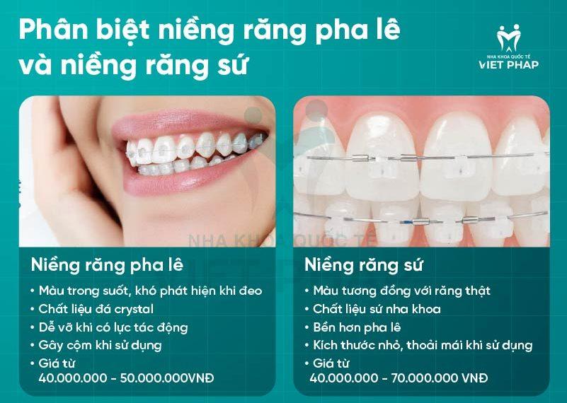 nieng rang pha le 4 Phân biệt niềng răng pha lê và niềng răng sứ