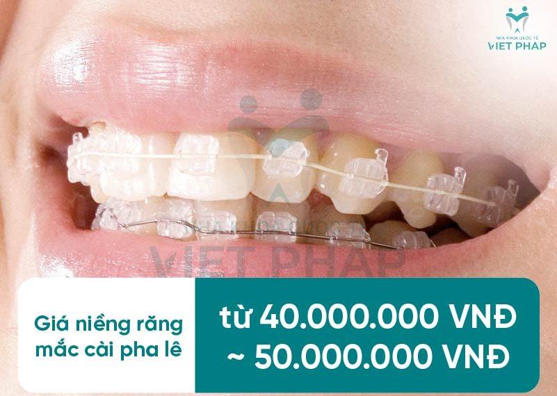 nieng rang pha le 7 Giá niềng răng mắc cài pha lê