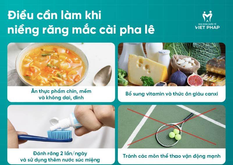 nieng rang pha le 8 Điều cần biết khi niềng răng mắc cài pha lê