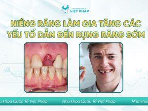 tac hai cua nieng rang 4 Niềng răng làm gia tăng yếu tố dẫn đến rụng răng sớm