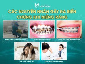 tac hai cua nieng rang 6 Các nguyên nhân gây ra biến chứng khi niềng răng