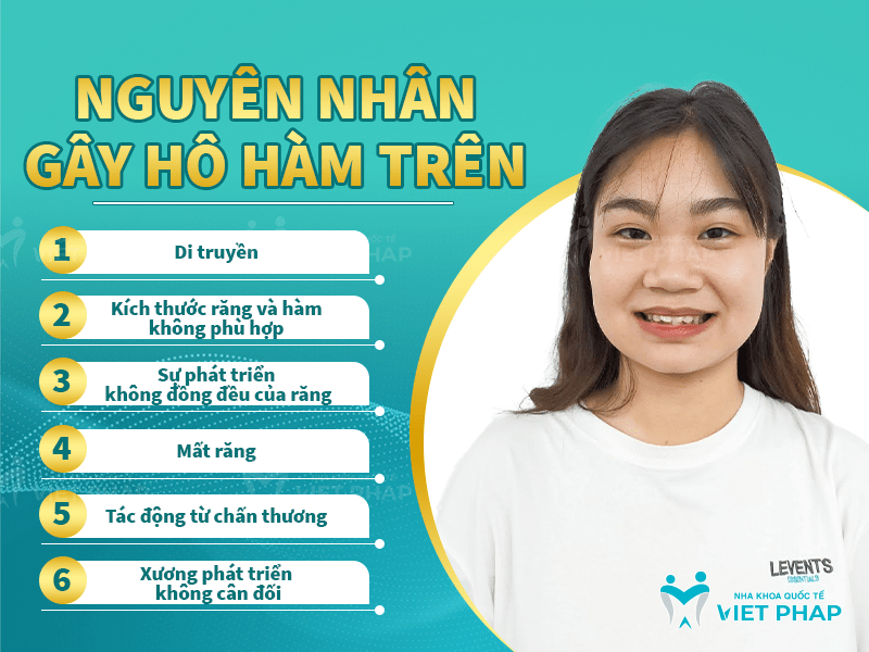 1 2 Nguyên nhân gây hô hàm trên