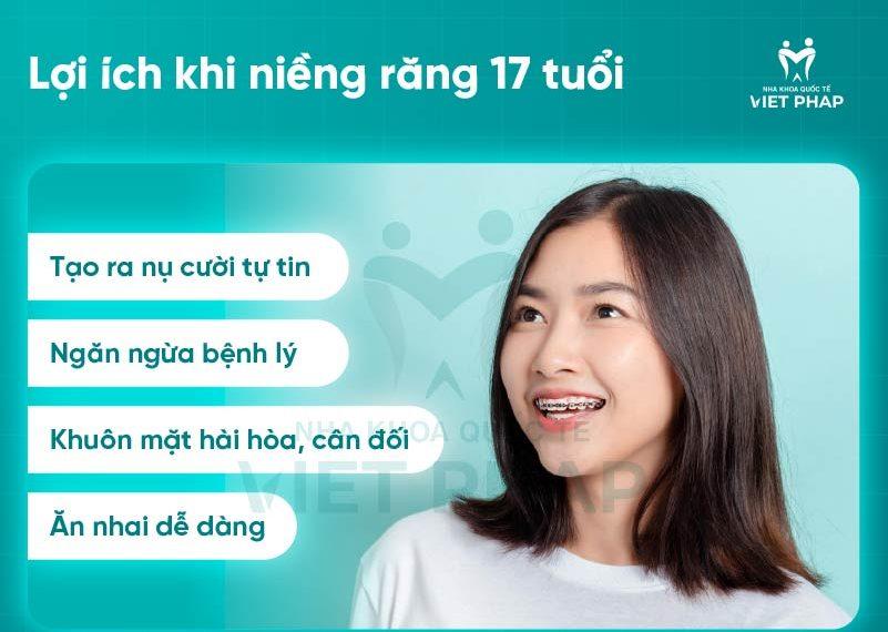 17 tuoi nieng rang bao nhieu tien 1 Những lợi ích khi niềng răng 17 tuổi