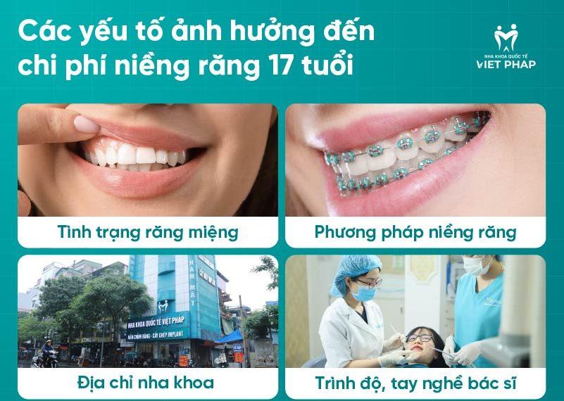 17 tuoi nieng rang bao nhieu tien 3 Các yếu tố ảnh hưởng đến chi phí niềng răng 17 tuổi
