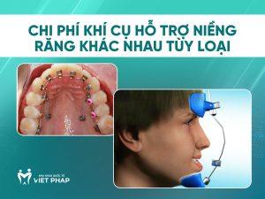 Chi phí khí cụ hỗ trợ niềng răng