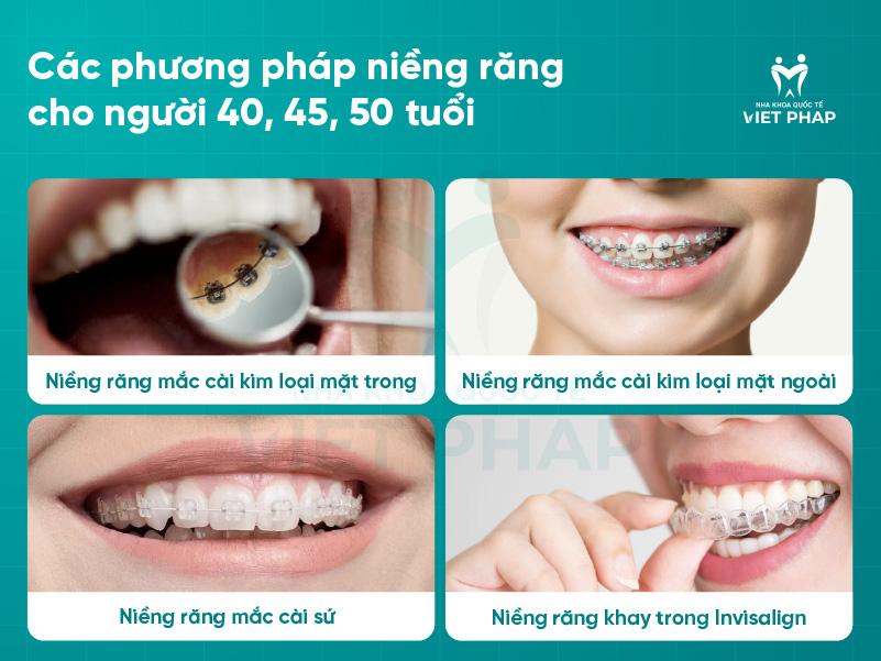2 3 Các phương pháp niềng răng cho người 40, 45, 50 tuổi