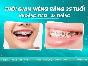 Thời gian niềng răng 25 tuổi
