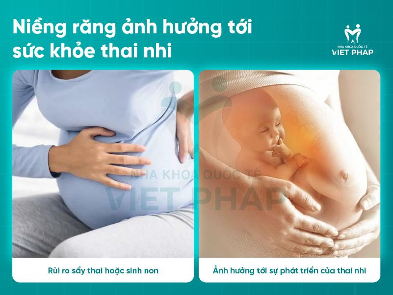 Niềng răng hưởng tới sức khỏe thai nhi
