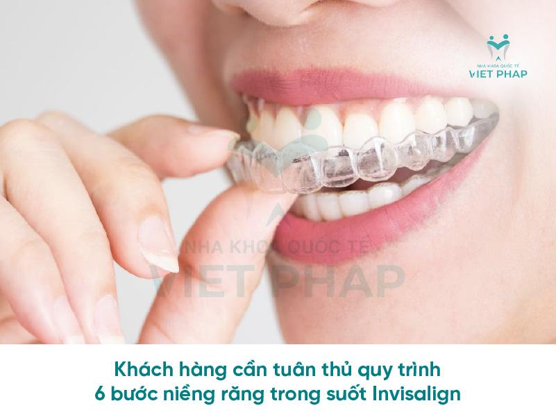 Khách hàng cần tuân thủ quy trình 6 bước niềng răng trong suốt Invisalign