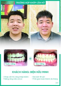 Khách hàng Biện Hữu Minh