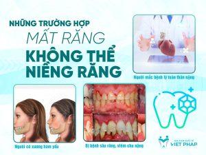 Những trường hợp mất răng không thể niềng răng 
