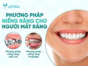 Phương pháp niềng răng cho người mất răng 