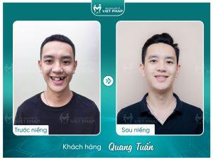 Khách hàng Quang Tuấn