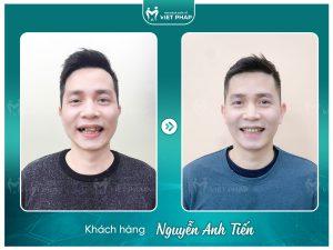Khách hàng Nguyễn Anh Tiến