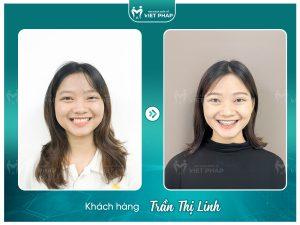 Khách hàng Trần Thị Linh
