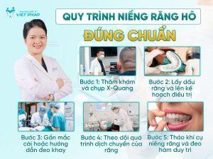 Quy trình niềng răng hô đúng chuẩn