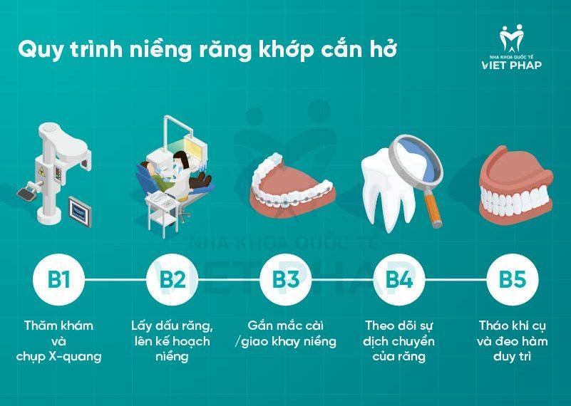 Quy trình niềng răng khớp cắn hở