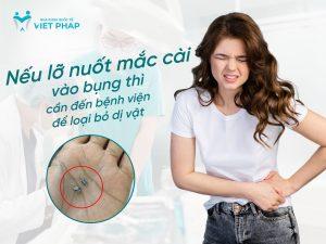 cần đến bác sĩ khi lỡ nuốt mắc cài