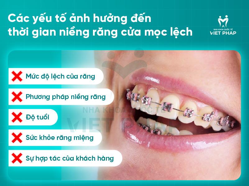nieng rang cua moc lech mat bao lau 2 Các yếu tố ảnh hưởng đến thời gian niềng răng cửa mọc lệch