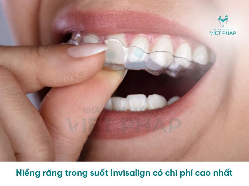 nieng rang cua moc lech mat bao lau 4 Niềng răng invisalign có chi phí cao nhất