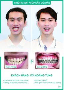 nieng rang khop can doi dau vu hoang tung Khách hàng Võ Hoàng Tùng