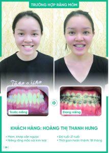 Khách hàng Hoàng Thị Thanh Hưng