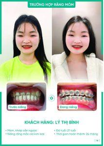 Khách hàng Lý Thị Bình