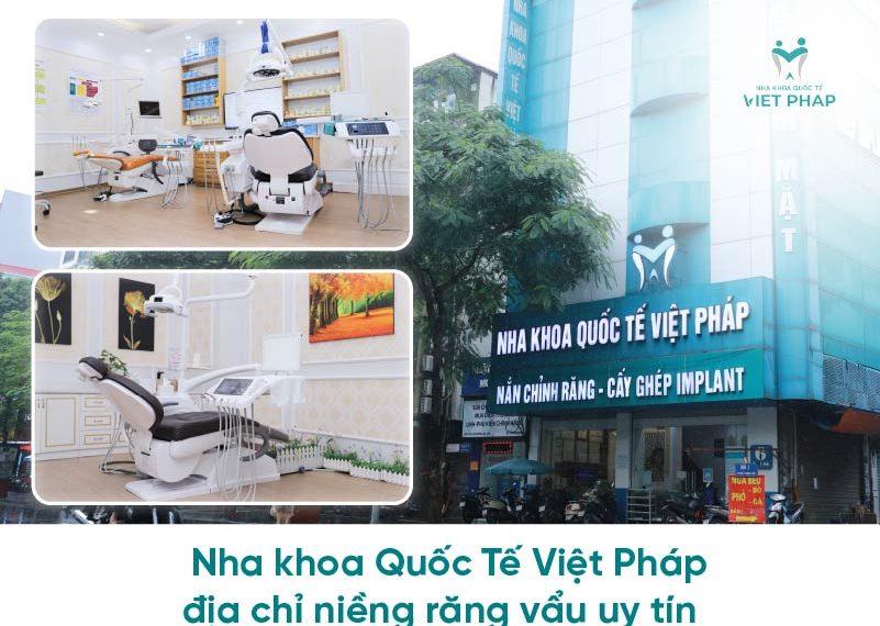 nieng rang vau 3 Nha khoa quốc tế Việt Pháp - địa chỉ niềng răng vẩu uy tín