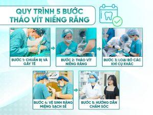 Quy trình tháo vít niềng răng có 5 bước