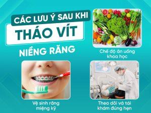 Các lưu ý khi tháo vít niềng răng